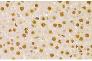 Immunohistochemistry of paraffin-embedded Rat liver using CDC25A Polyclonal Antibody at dilution of 1:100 (40x lens). (CDC25A 抗体)