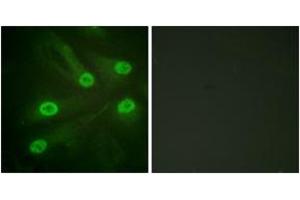 Immunofluorescence analysis of HeLa cells, using p53 (Acetyl-Lys386) Antibody. (p53 抗体  (acLys386))