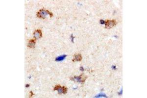 Immunohistochemical analysis of Dynamin 1 staining in human brain formalin fixed paraffin embedded tissue section. (Dynamin 1 抗体  (C-Term))