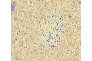 Immunohistochemistry of paraffin-embedded human liver tissue using ABIN7162471 at dilution of 1:100 (PAN2 抗体  (AA 628-908))