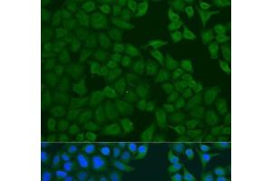 Immunofluorescence analysis of U2OS cells using FERMT3 Polyclonal Antibody at dilution of 1:100. (FERMT3 抗体)
