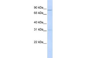 WB Suggested Anti-POMT1 Antibody Titration:  0. (POMT1 抗体  (Middle Region))