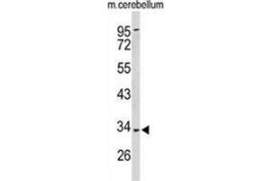 Western blot analysis of Peroxin 2 / PEX2 / RNF72 (arrow) in mouse cerebellum tissue lysates (35ug/lane) using Peroxin 2 / PEX2 / RNF72  (PEX2 抗体  (Middle Region))