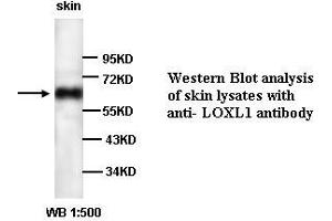 Image no. 1 for anti-Lysyl Oxidase-Like 1 (LOXL1) antibody (ABIN790875) (LOXL1 抗体)
