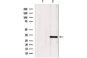 Western blot analysis of extracts from Mouse Myeloma cell, using GNMT antibody. (GNMT 抗体  (Internal Region))