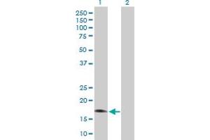 Western Blot analysis of RGS3 expression in transfected 293T cell line by RGS3 MaxPab polyclonal antibody. (RGS3 抗体  (AA 1-168))