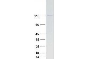 Western Blotting (WB) image for Cbl Proto-Oncogene B, E3 Ubiquitin Protein Ligase (CBLB) protein (Myc-DYKDDDDK Tag) (ABIN2713255)