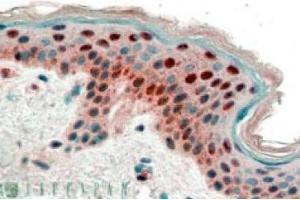 Image no. 1 for anti-Stratifin (SFN) (Internal Region), (N-Term) antibody (ABIN374638) (14-3-3 sigma/SFN 抗体  (Internal Region, N-Term))
