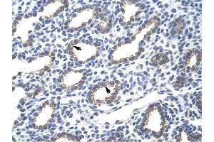 Cytokeratin 18 antibody was used for immunohistochemistry at a concentration of 4-8 ug/ml to stain Alveolar cells (arrows) in Human Lung. (Cytokeratin 18 抗体  (N-Term))