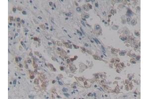 Detection of SPD in Human Lung Tissue using Polyclonal Antibody to Surfactant Associated Protein D (SPD) (SFTPD 抗体  (AA 21-375))