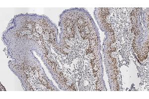 Human skin: immunohistochemical staining for Androgen Receptor. (Androgen Receptor 抗体  (N-Term))