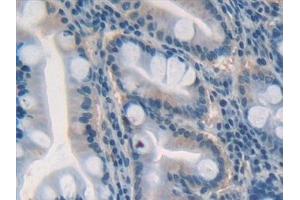 Detection of GDF5 in Human Stomach Tissue using Polyclonal Antibody to Growth Differentiation Factor 5 (GDF5) (GDF5 抗体  (AA 86-501))