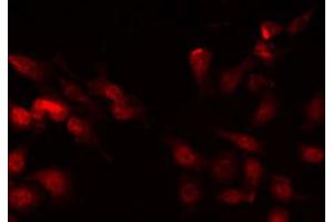 ABIN6268826 staining HepG2 by IF/ICC. (ZEB2 抗体  (N-Term))