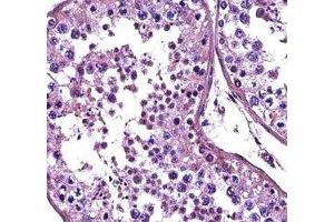 HDAC4 antibody immunohistochemistry analysis in formalin fixed and paraffin embedded human testis tissue. (HDAC4 抗体  (AA 1049-1077))