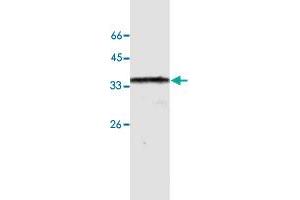 Western blot analysis of HeLa whole cell lystae with ANXA10 monoclonal antibody, clone 24  at 1:500 dilution. (Annexin a10 抗体  (AA 168-324))