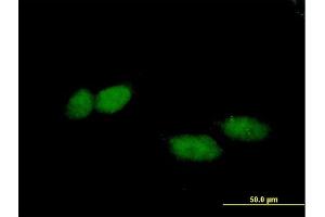 Immunofluorescence of purified MaxPab antibody to TBL1X on HeLa cell. (TBL1X 抗体  (AA 1-526))