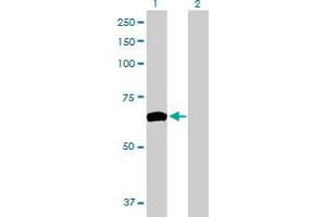 Western Blot analysis of ZNF10 expression in transfected 293T cell line by ZNF10 MaxPab polyclonal antibody. (ZNF10 抗体  (AA 1-573))