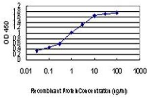Detection limit for recombinant GST tagged ZIC4 is approximately 0. (ZIC4 抗体  (AA 249-319))