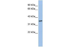 WB Suggested Anti-PHF13 Antibody Titration:  0. (PHF13 抗体  (N-Term))