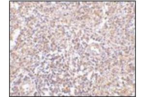 Immunohistochemistry of RAP80 in human spleen tissue with this product at 2. (UIMC1 抗体  (N-Term))
