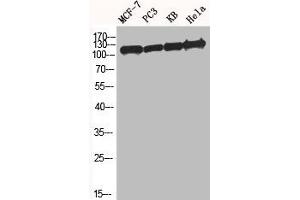 Western Blot analysis of MCF7 PC-3 KB HELA cells using BM28 Polyclonal Antibody (MCM2 抗体  (N-Term))