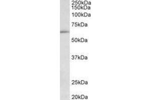 Image no. 1 for anti-Hypermethylated in Cancer 2 (HIC2) (AA 188-200) antibody (ABIN1102028) (HIC2 抗体  (AA 188-200))