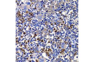 Immunohistochemistry of paraffin-embedded rat spleen using STAMBP antibody at dilution of 1:100 (x400 lens). (STAMBP 抗体)