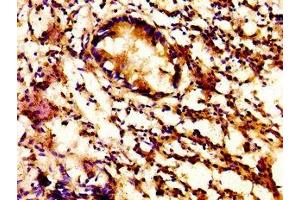 IHC image of ABIN7154307 diluted at 1:500 and staining in paraffin-embedded human appendix tissue performed on a Leica BondTM system. (ACBD3 抗体  (AA 263-366))