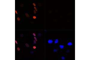 Immunofluorescence analysis of NIH/3T3 cells using Acetyl-Histone H3-K56 Rabbit pAb (ABIN7267674) at dilution of 100 (40x lens).