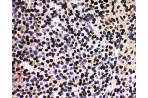 IHC-F testing of Splicing factor 1 antibody and rat spleen tissue