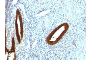 Immunohistochemistry (IHC) image for anti-Keratin 19 (KRT19) antibody (ABIN6939947)