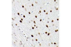 Immunohistochemistry of paraffin-embedded rat brain using S Rabbit pAb (ABIN6130296, ABIN6147396, ABIN6147398 and ABIN6221485) at dilution of 1:200 (40x lens). (SATB1 抗体  (AA 484-763))