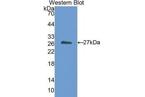 Western Blotting (WB) image for anti-Cholesteryl Ester Transfer Protein (CETP) (AA 81-311) antibody (ABIN1173657) (CETP 抗体  (AA 81-311))