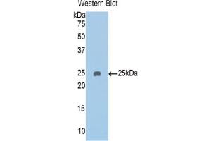 Western blot analysis of the recombinant protein. (PAPPA2 抗体  (AA 888-1093))