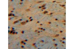 Used in DAB staining on fromalin fixed paraffin-embedded brain tissue (CNTF 抗体  (AA 2-200))