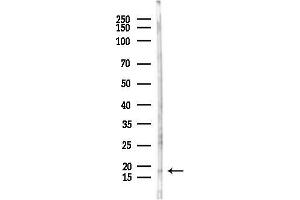 anti-Phospholipase A2, Group X (PLA2G10) antibody