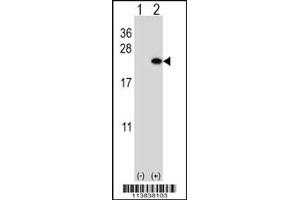 Western blot analysis of BarX1 using rabbit polyclonal BarX1 Antibody using 293 cell lysates (2 ug/lane) either nontransfected (Lane 1) or transiently transfected (Lane 2) with the BarX1 gene. (BARX1 抗体  (C-Term))