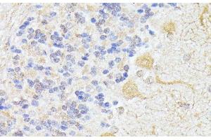 Immunohistochemistry of paraffin-embedded Rat cerebellum using ELP3 Polyclonal Antibody at dilution of 1:100 (40x lens). (ELP3/KAT9 抗体)