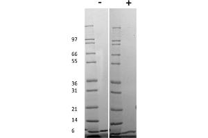 SDS-PAGE (SDS) image for Chemokine (C-X-C Motif) Ligand 1 (Melanoma Growth Stimulating Activity, Alpha) (CXCL1) protein (ABIN6699668)