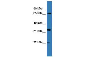 WB Suggested Anti-DOK4 Antibody Titration: 0. (DOK4 抗体  (N-Term))