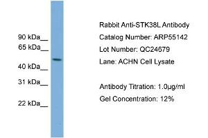 WB Suggested Anti-STK38L  Antibody Titration: 0. (STK38L 抗体  (Middle Region))