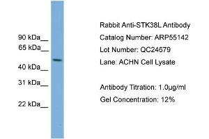 WB Suggested Anti-STK38L  Antibody Titration: 0.