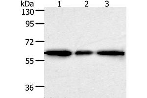 Western Blot analysis of Human liver cancer tissue, hela and 293T cell using AKR1A1 Polyclonal Antibody at dilution of 1:500 (AKR1A1 抗体)