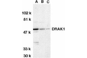 Image no. 1 for anti-serine/threonine Kinase 17a (STK17A) (AA 5-19) antibody (ABIN203102) (STK17A 抗体  (AA 5-19))