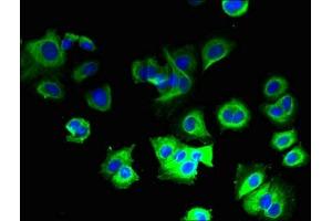 Immunofluorescent analysis of MCF-7 cells using ABIN7149171 at dilution of 1:100 and Alexa Fluor 488-congugated AffiniPure Goat Anti-Rabbit IgG(H+L) (COX5B 抗体  (AA 32-129))