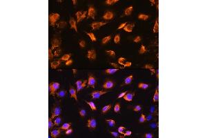 Immunofluorescence analysis of C6 cells using alpha Sarcoglycan (alpha Sarcoglycan (SGCA)) Rabbit pAb (ABIN1682687, ABIN5664644, ABIN5664646 and ABIN6220497) at dilution of 1:100. (SGCA 抗体  (AA 60-290))