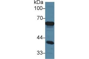 Detection of AFP in Mouse Cerebrum lysate using Polyclonal Antibody to Alpha-Fetoprotein (AFP) (alpha Fetoprotein 抗体  (AA 409-611))