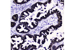 Immunohistochemistry (IHC) image for anti-Cytochrome C Oxidase Subunit IV Isoform 1 (COX4I1) (AA 59-169) antibody (ABIN5692827)