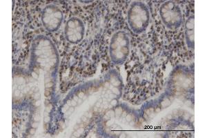 Immunostaining (ISt) image for anti-USO1 Homolog, Vesicle Docking Protein (USO1) (AA 1-961) antibody (ABIN522073)