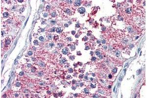 Testis, Human: Formalin-Fixed, Paraffin-Embedded (FFPE) (PKC zeta 抗体  (Cytoplasmic Domain))